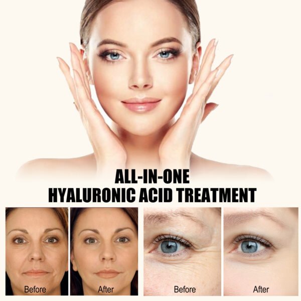 jaysuing hyaluronic acid serum lightens eye bags, dark circles, anti wrinkles, firms and brightens the skin