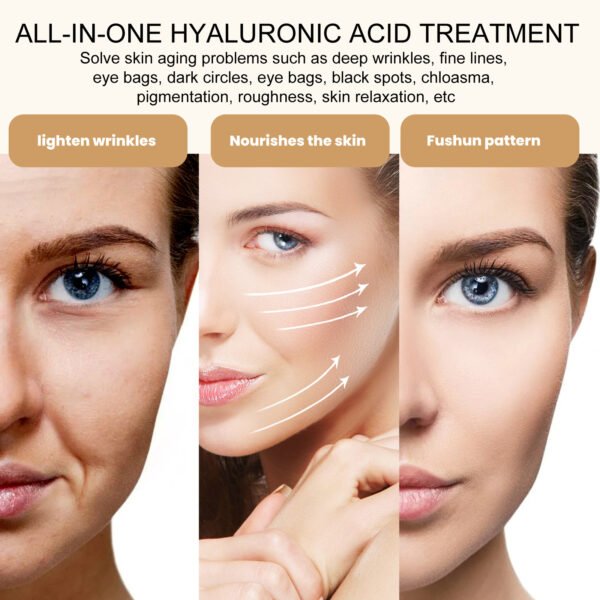 jaysuing hyaluronic acid serum lightens eye bags, dark circles, anti wrinkles, firms and brightens the skin